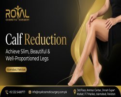 What to Expect from Calf Reduction in Islamabad