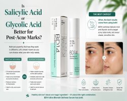 Is Salicylic Acid or Glycolic Acid Better for Post-Acne Marks?