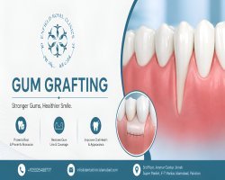Gum Grafting in Islamabad for Receding Gum Correction