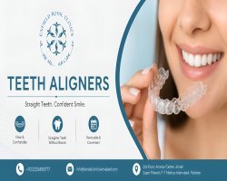 Discover Advanced Teeth Aligners in Islamabad Today