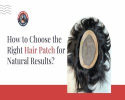 How to Choose the Right Hair Patch for Natural Results?