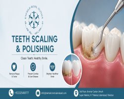 Dental Scaling and Polishing Services in Islamabad