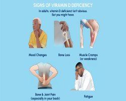 Vitamin D Deficiency: Signs, Causes, and Why a Simple Test Matters