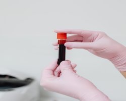 United States Plasma Therapy Market Shaping the Future of Plasma-Based Treatment