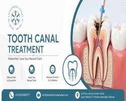 Tooth Canal Treatment in Islamabad for Dental Relief