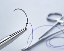 United States Suture Needle Market The Changing Landscape of Surgical Closure Technologies